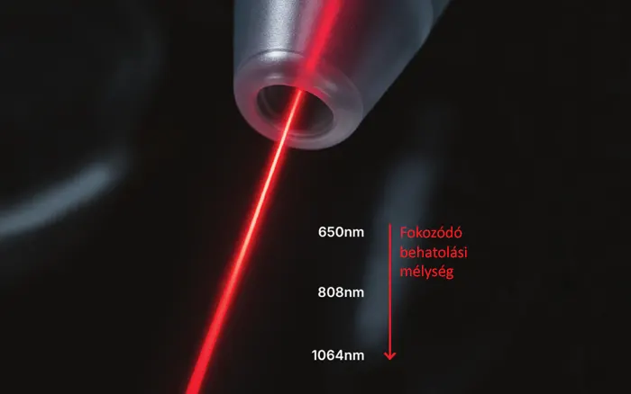 laserfeny.hu